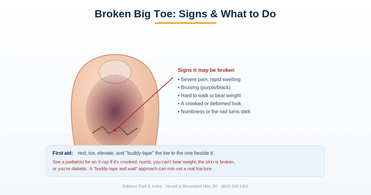 Diagram of broken big toe signs (swelling, bruising, deformity) and first aid including buddy taping and when to get an X-ray - Balance Foot & Ankle, Howell MI