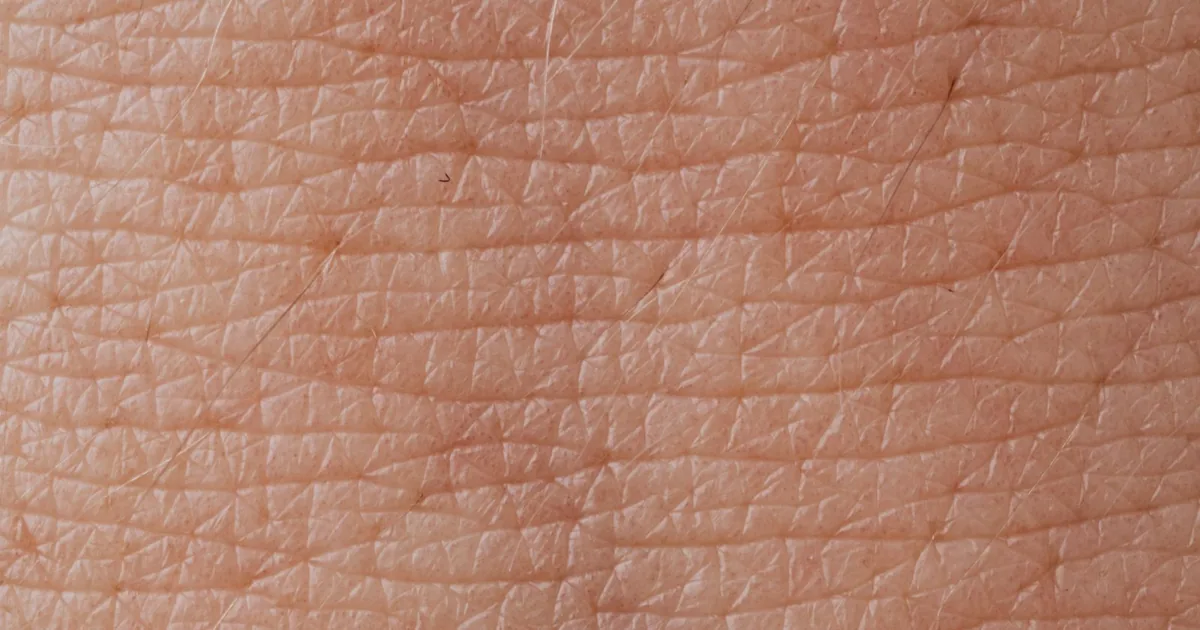 Hard skin on feet and callus treatment - Balance Foot & Ankle, Howell MI