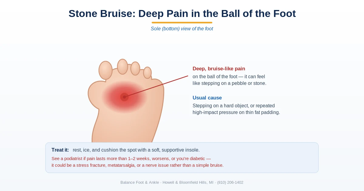 Diagram of a stone bruise - deep pain on the ball of the foot that feels like stepping on a pebble - Balance Foot & Ankle, Howell MI