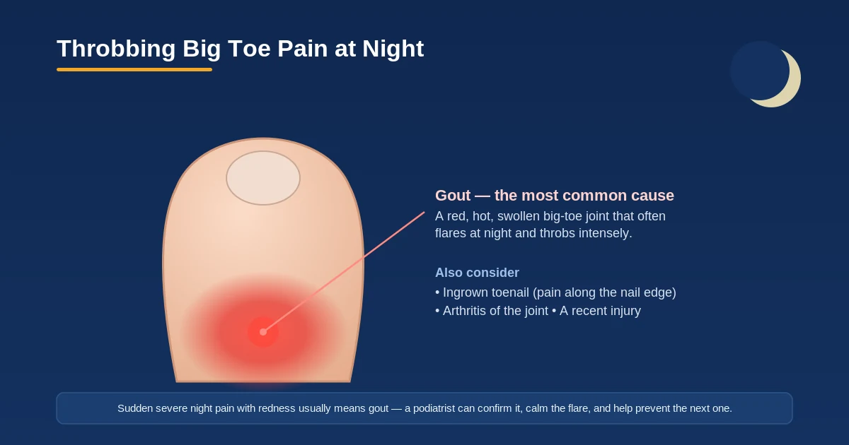 Diagram of throbbing big toe pain at night - most often gout (red, hot, swollen joint), also ingrown toenail or arthritis - Balance Foot & Ankle, Howell MI