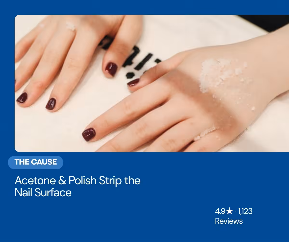 Removing nail polish with a cotton pad — acetone strips the nail surface and causes keratin granulations, Balance Foot & Ankle Howell MI