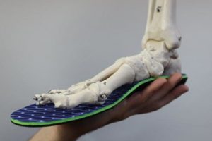 Top of the foot pain best orthotics