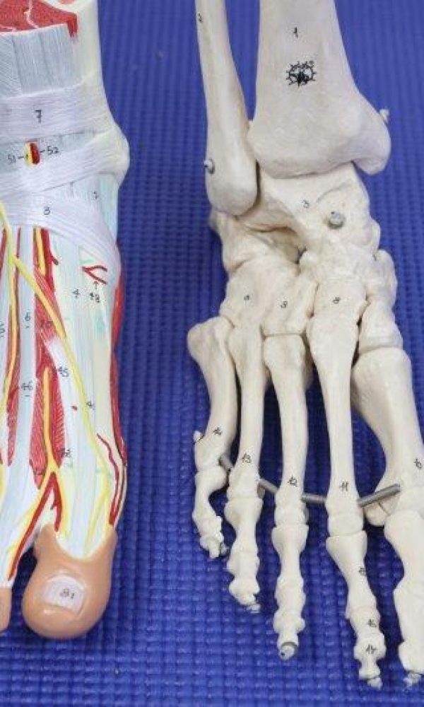 High Ankle Sprain Syndesmosis tear recovery time High Ankle Sprain Syndesmosis tear recovery time