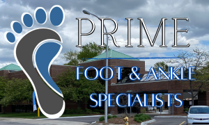 Prime Foot & Ankle Specialists Beverly Hills Michigan Podiatrists and Foot Doctors