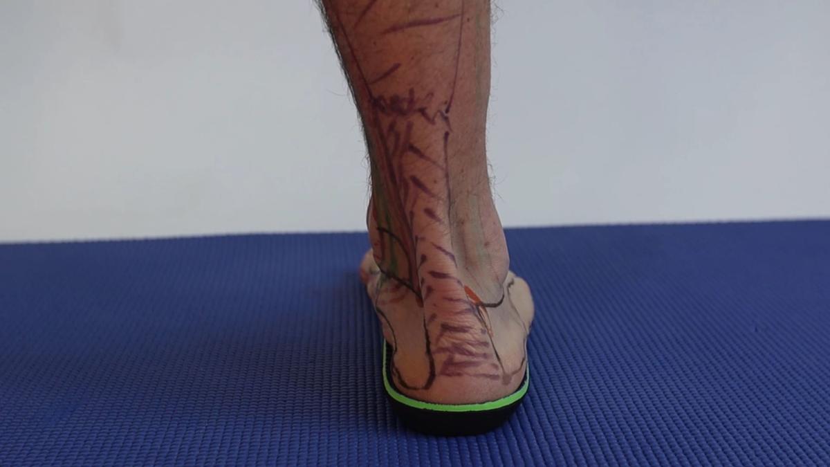Insoles for hotsell cuboid syndrome