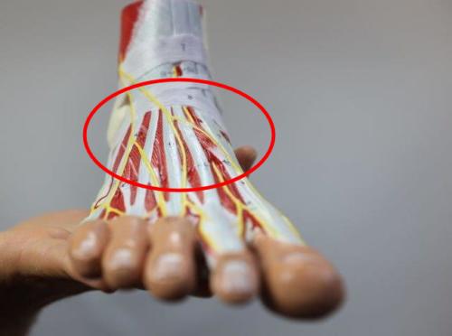 Radiating nerve pain on top of the foot