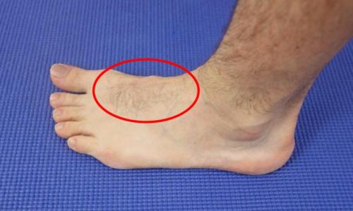 Pain Across the Top of the Foot: Causes, Symptoms & Best Treatment