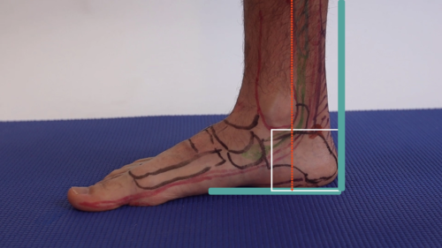 Heel pain and heel insertion