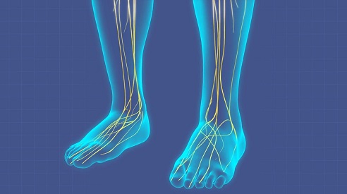 Superficial peroneal nerve compression top of the foot