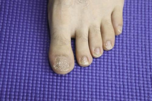 White Chalky toenails after removing toenail polish.