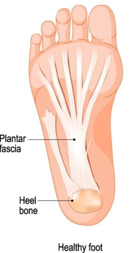 Plantar fasciitis anatomy bottom of the heel