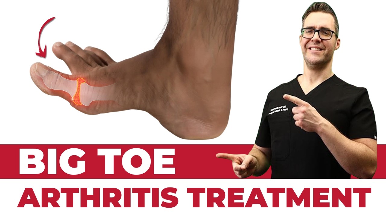 Stiff Big Toe Joint Pain(Hallux Rigidus) TREATMENT [Exercises, Taping]