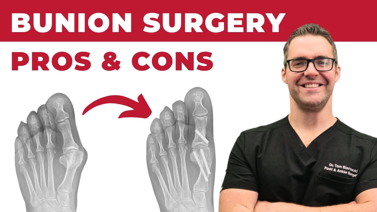 6 Best Bunion Surgery Pros & Cons — Get the Fastest Recovery Time | Dr. Tom Biernacki DPM