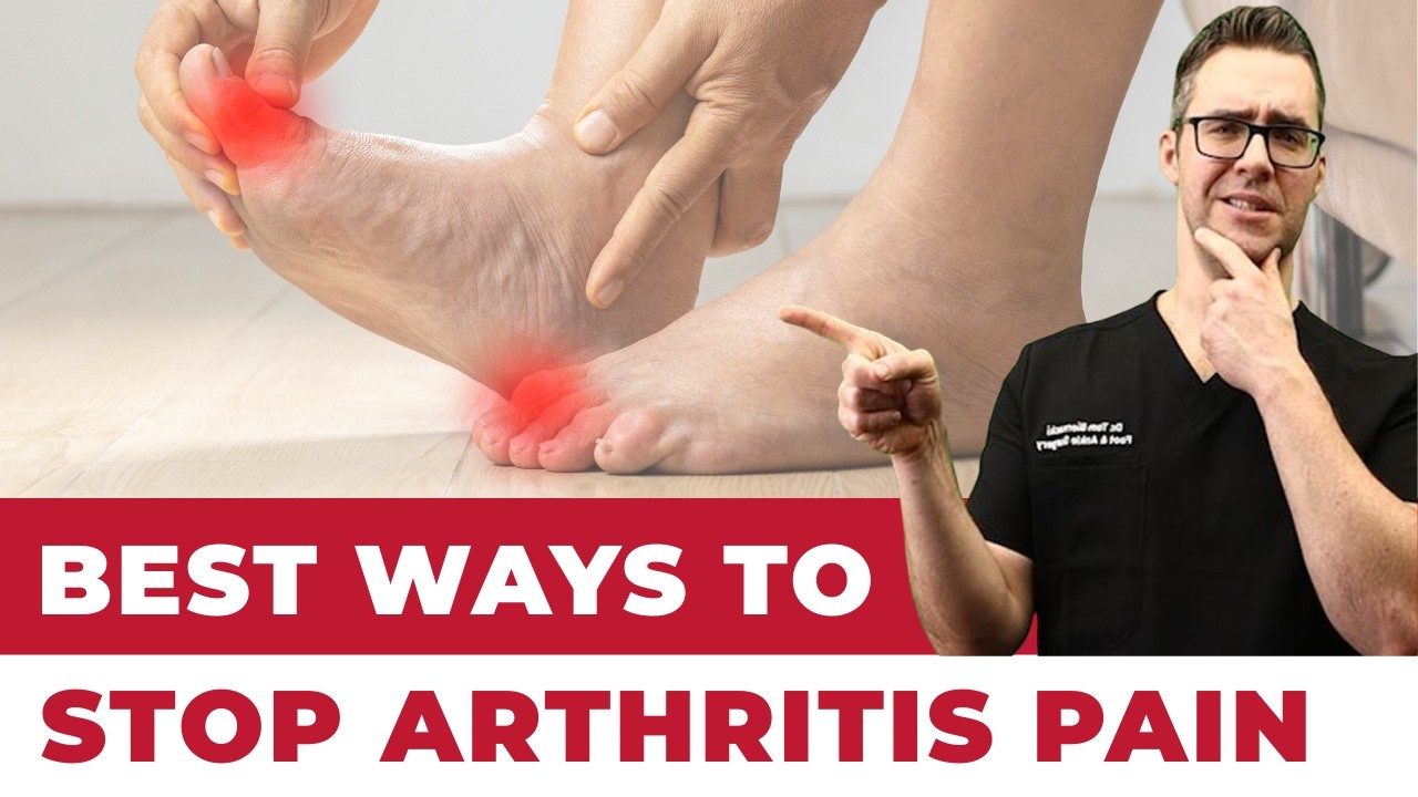 Secret Treatment That OUTSMARTS Arthritis Pain [2023 SECRETS!]
