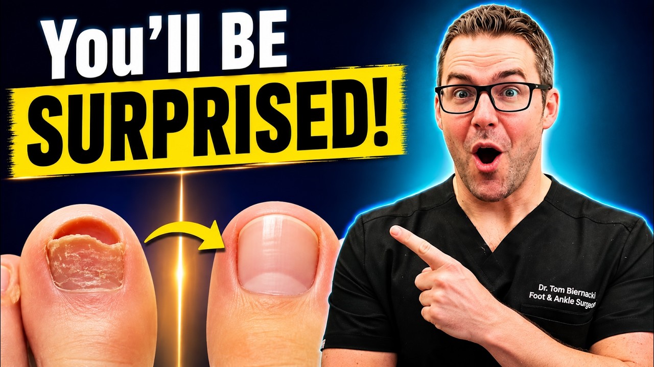 Watch: Dr. Biernacki Explains Thick Toenails