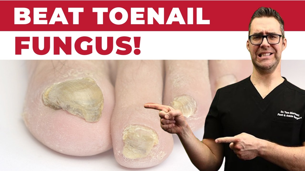 Top Toenail Fungus Treatments Doctors Recommend [+4 Tips] 2026