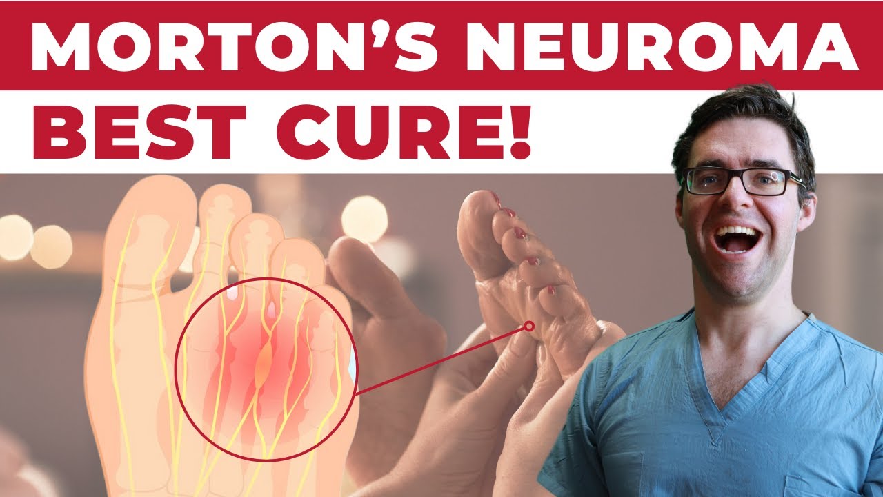 11 BEST Mortons Neuroma Massage, Exercise & Stretch Treatments [WOW!]