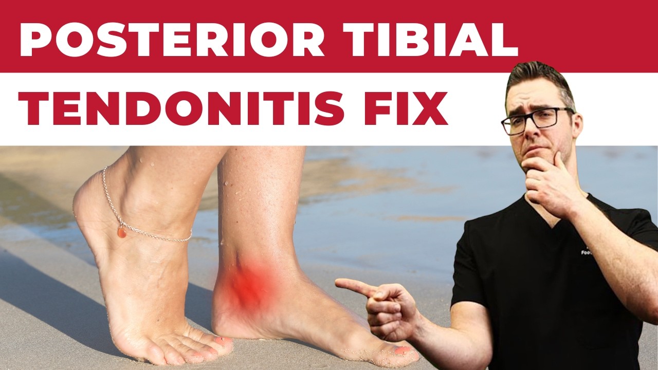 Inside of the Ankle Pain [Posterior Tibial Tendonitis Treatment]