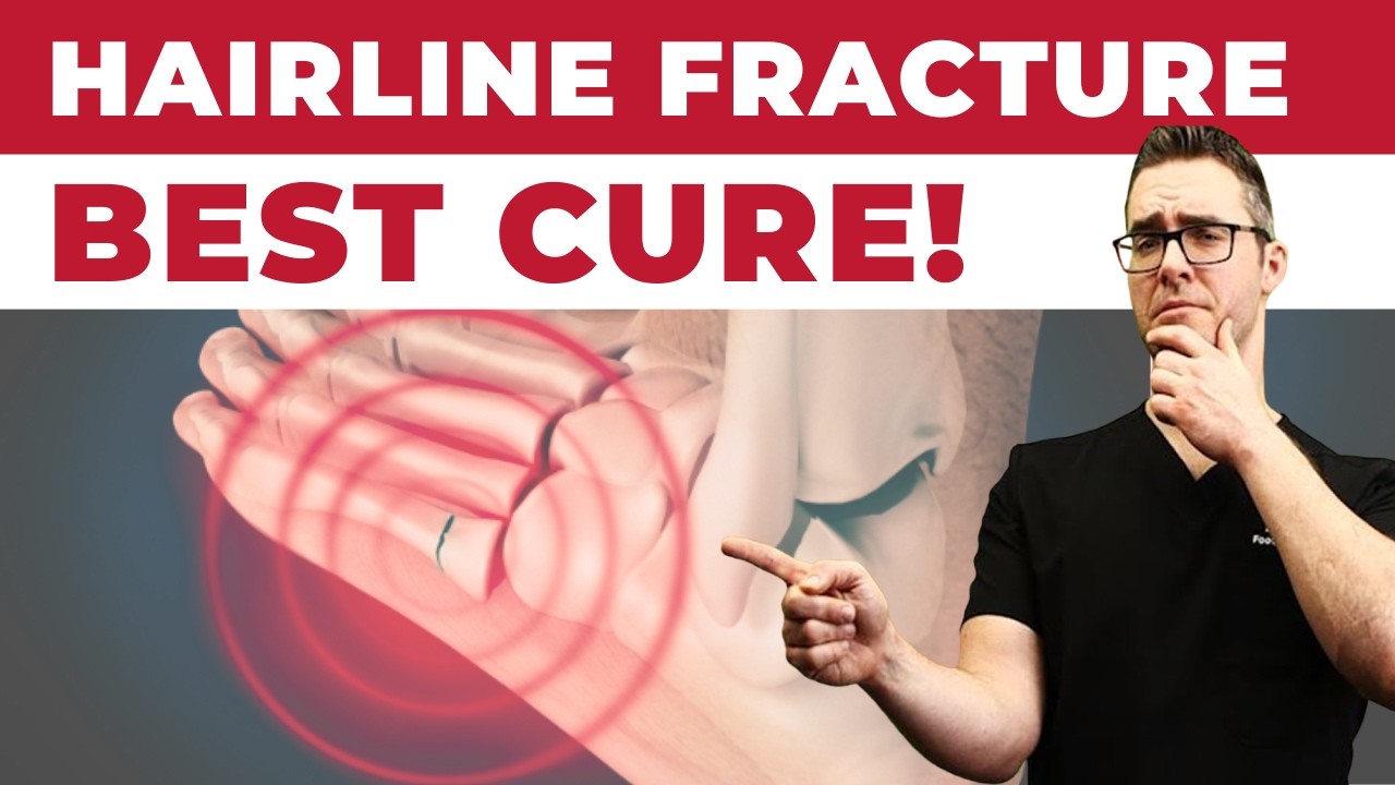 Hairline Stress Fracture in the Foot? [Symptoms & Best TREATMENT]