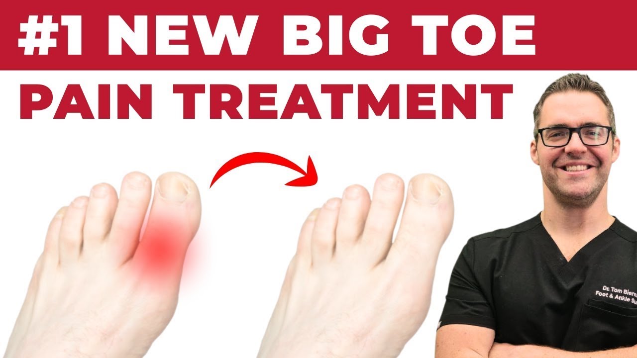 #1 Big Toe Joint Pain Cure [Arthritis? Sesamoiditis? Turf Toe? Gout?]