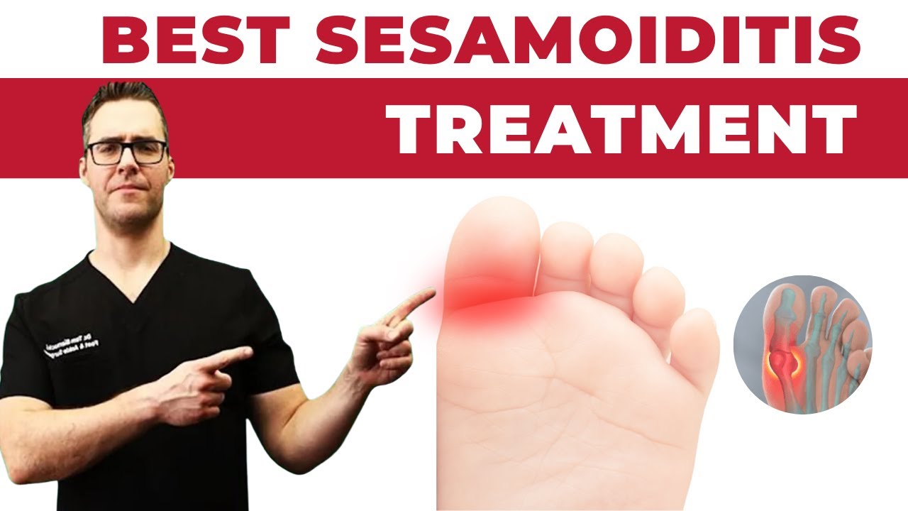 BEST Sesamoiditis Treatment [Sesamoid Bone Pain & Fracture FIX]