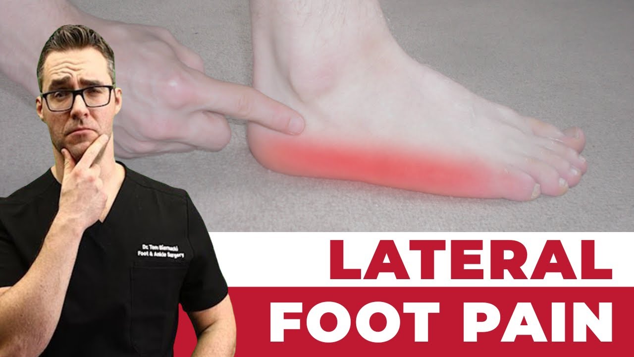 Side & Lateral Foot Pain FIX! [The BEST At-Home Relief Methods]