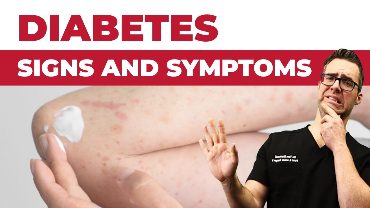 28 Diabetes Signs & Symptoms [REVERSE DIABETES + 2 BIG SECRETS!]