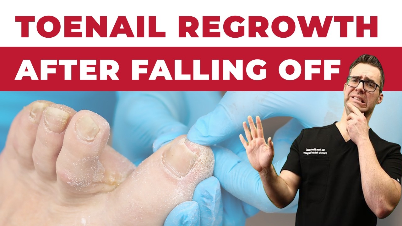 Why are my Toenails Falling Off? Toenail Regrowth After Falling Off