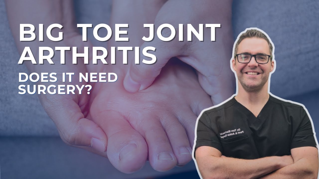 Is Bunion Surgery Worth It? [Big Toe Joint Arthritis]