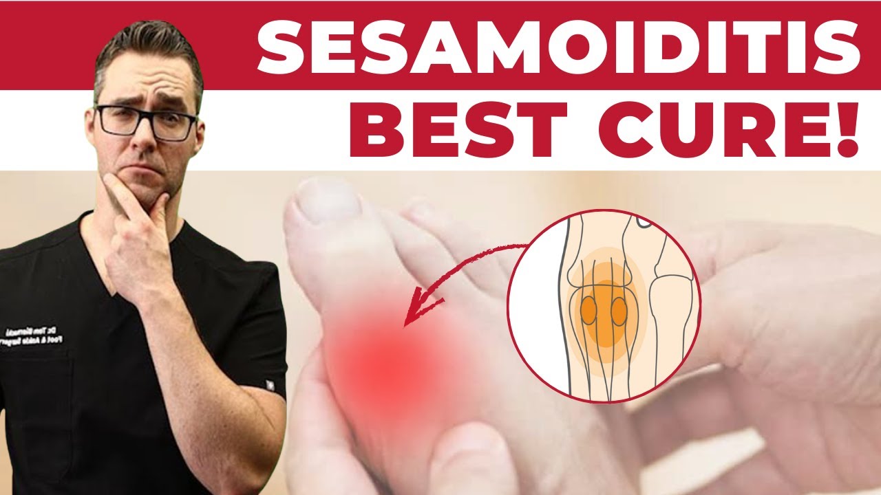 BEST Sesamoiditis Treatment: Big Toe Joint Pain