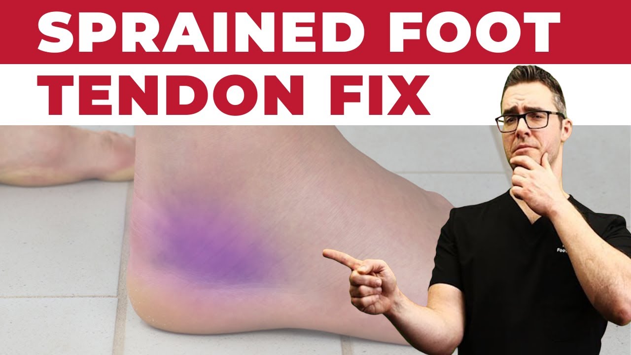 Ankle Sprains: Why Do They Take So Long To Heal? [BEST Home Treatments]