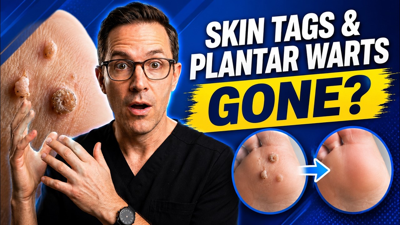 Skin Tags & Plantar Warts DISAPPEAR Overnight? [Best Home Remedies]