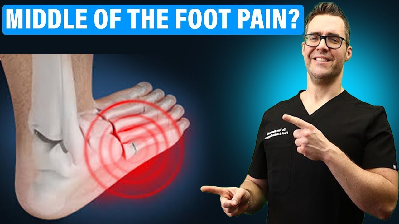 Lisfranc Injury Treatment & Recovery Time