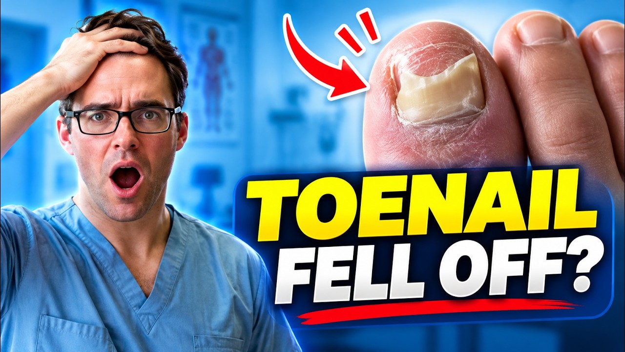 Toenail Falling Off? 4 Causes & How To Fix It Fast!