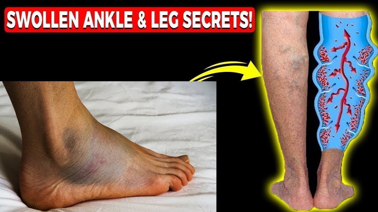 Dr. Tom Biernacki explains