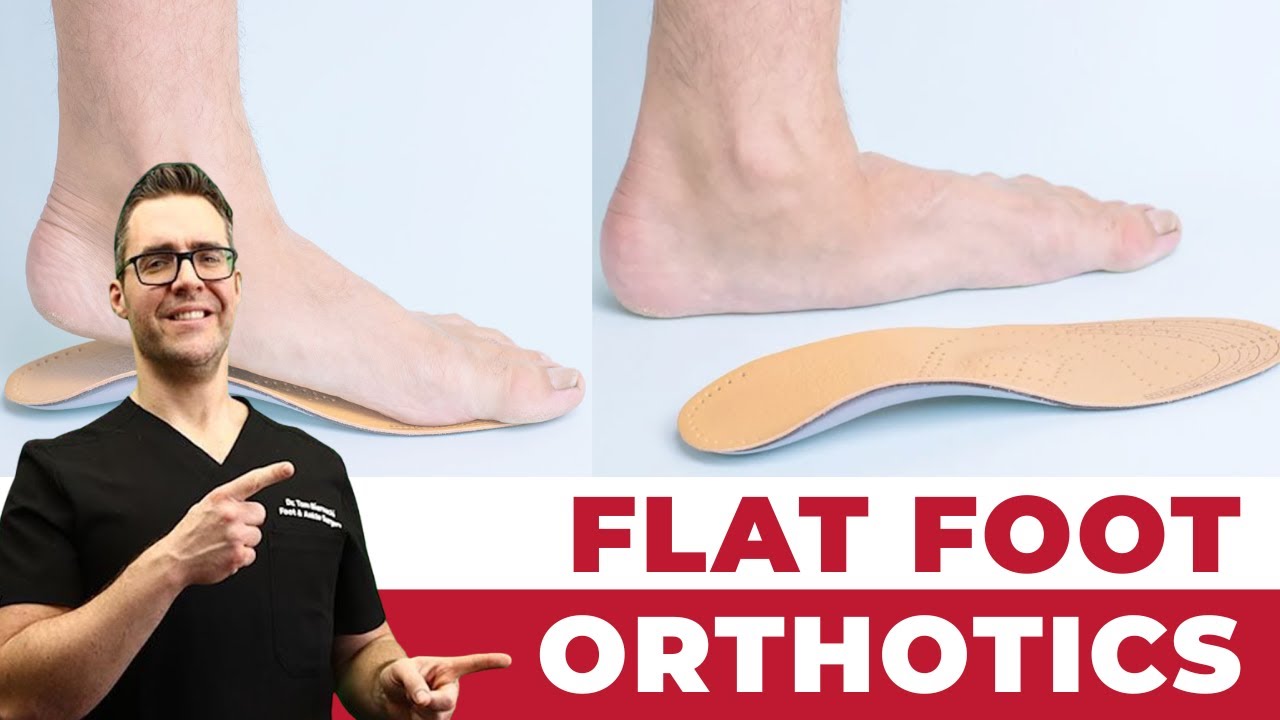 Best Orthotics For Flat Feet? WOW [$400 Custom Orthotics Worth It?]