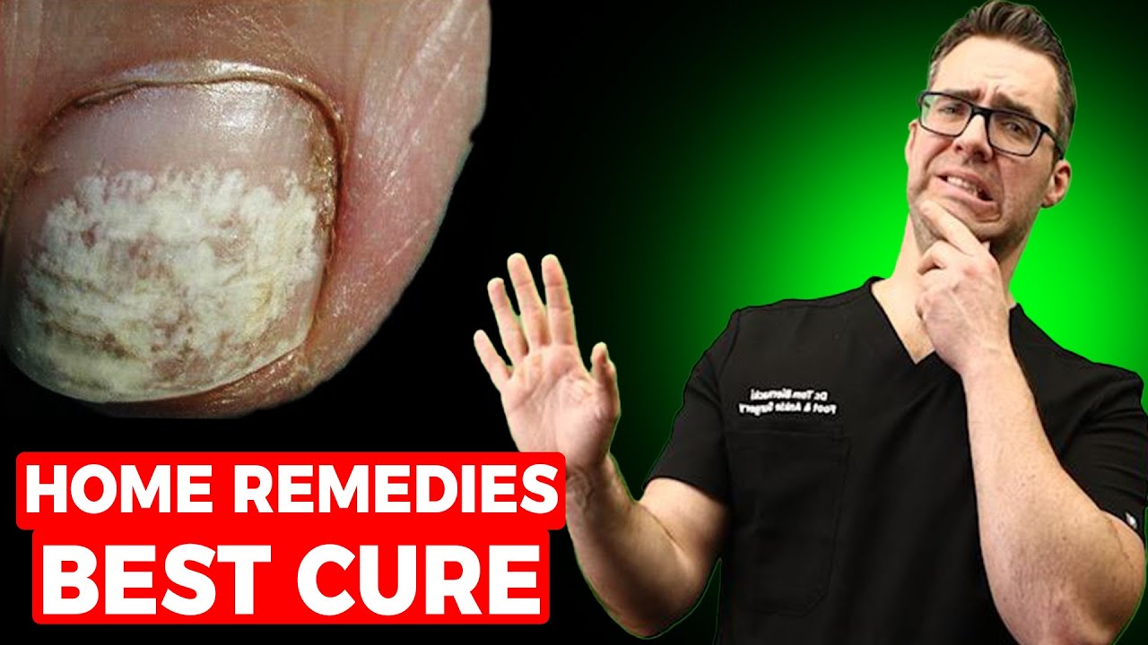 White Toenails After Polish or Pedicure? [Home Remedies & Best Cure!]