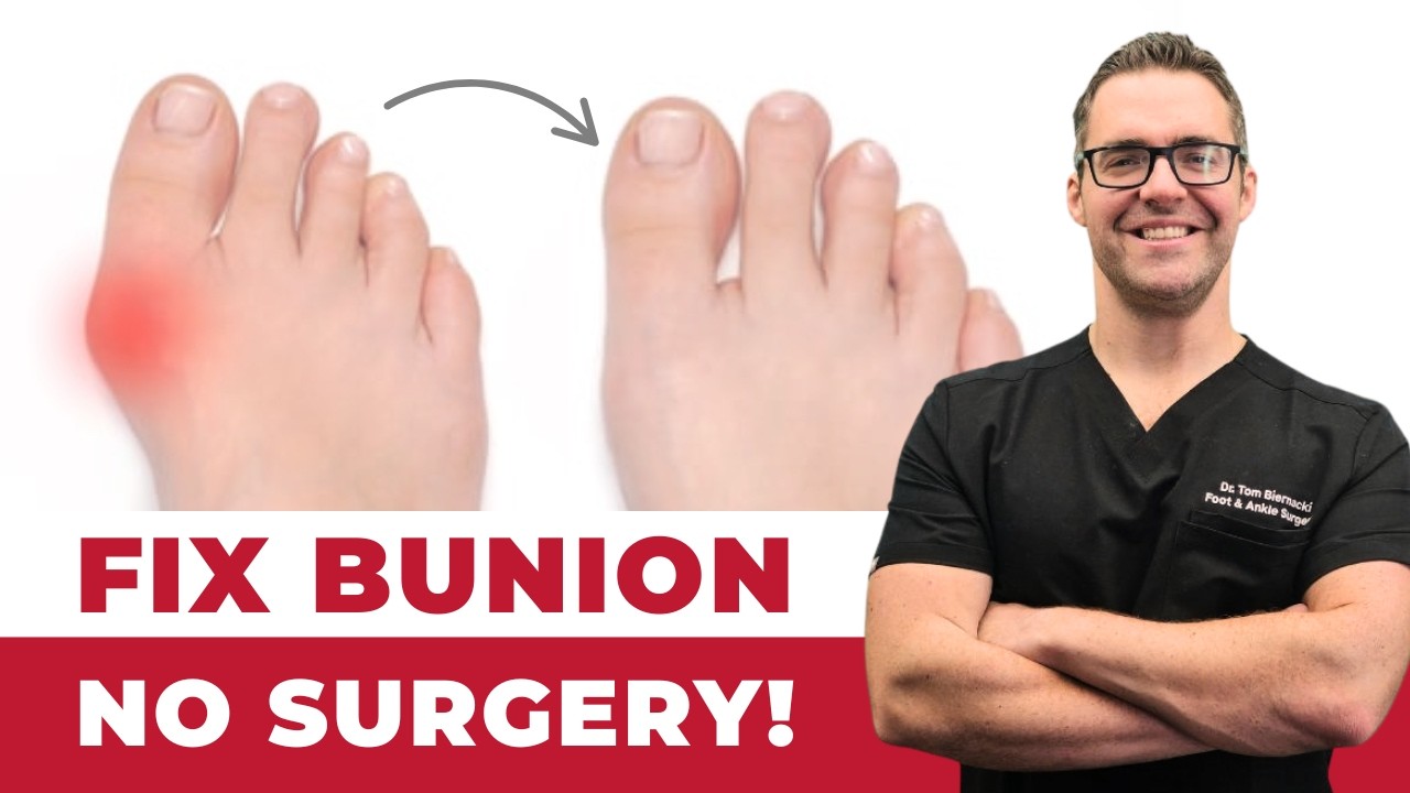 Bunion correction explained