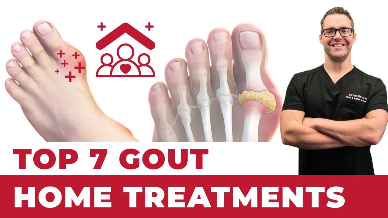 Gout Treatment and Prevention - Dr. Tom Biernacki