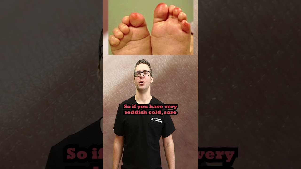 Foot & Toe Skin Conditions
