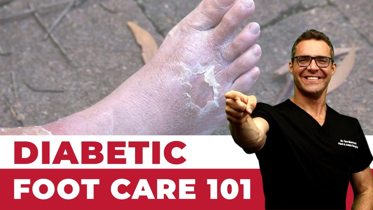 Diabetic Foot Care 101 [Diabetic Foot Pain: Podiatrist TREATMENT]