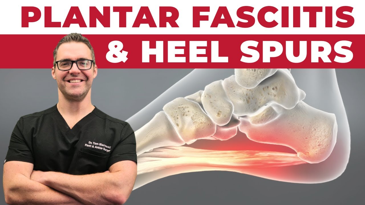Heel Spurs & Plantar Fasciitis [BEST Home Treatment!]
