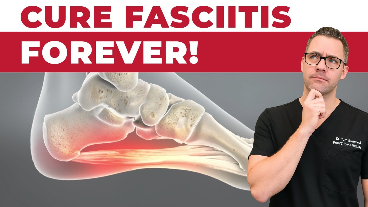 How To Cure Plantar Fasciitis FAST & FOREVER [Heel Pain & Heel Spurs]