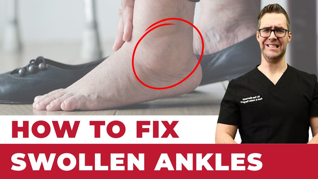 Dr. Tom Biernacki explains foot and ankle conditions — Balance Foot and Ankle Michigan