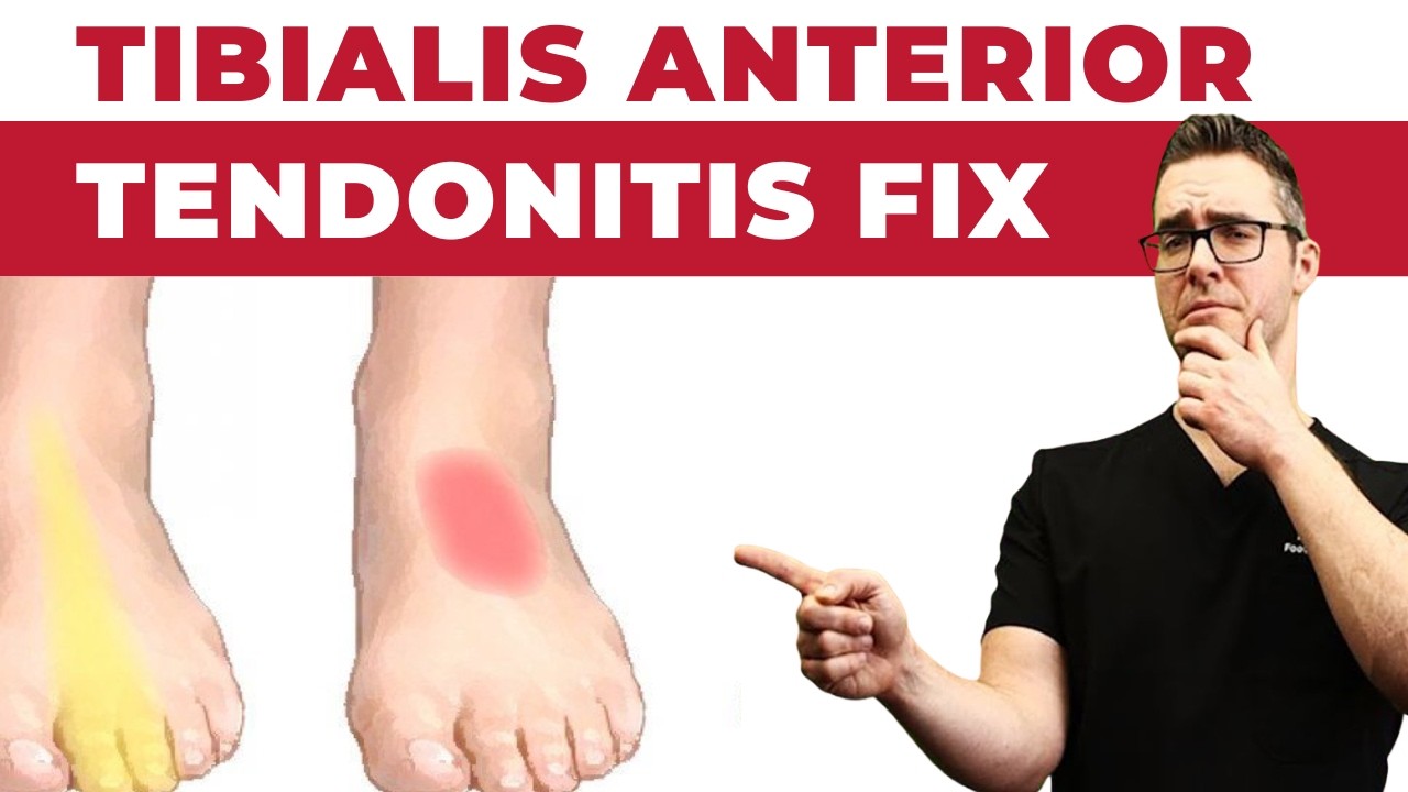 Tibialis Anterior Tendonitis [Tendonitis on TOP of Foot Treatment]