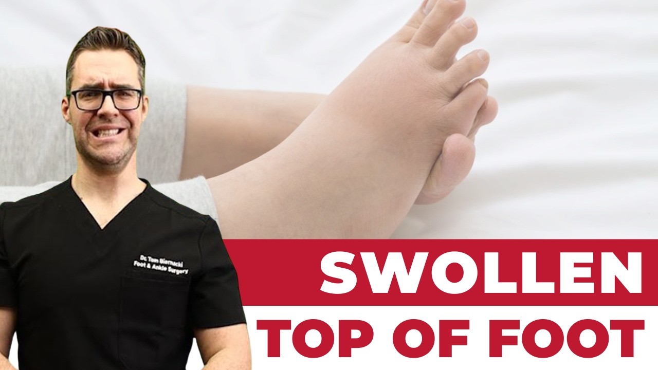 Video by Dr. Tom Biernacki, DPM — Michigan Foot Doctors