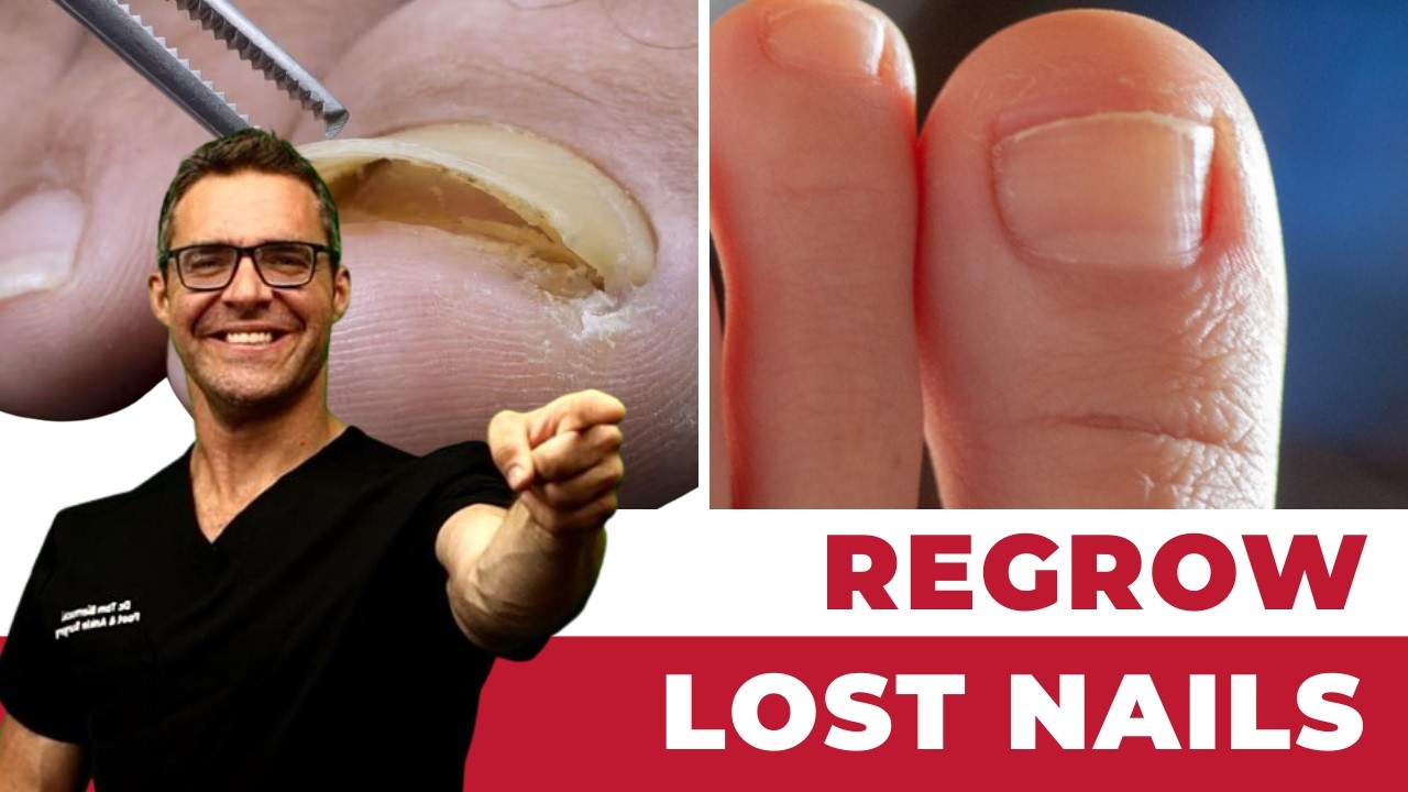 How Long Does It Take for Nails To Grow Back After Falling Off