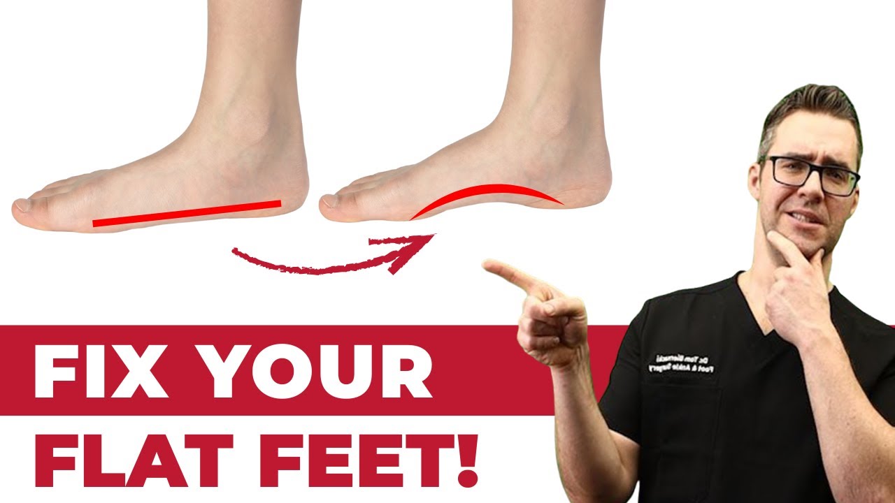 How to FIX Flat Feet Pain FOREVER [Overpronation vs. Supination] | Dr. Tom Biernacki