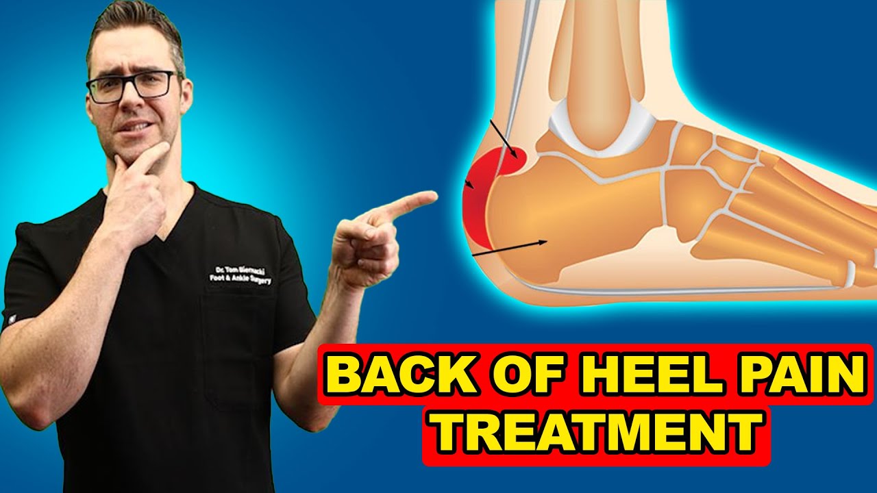 Back of the Heel Pain Causes & Relief [Heel Pain HOME Treatment 2021]