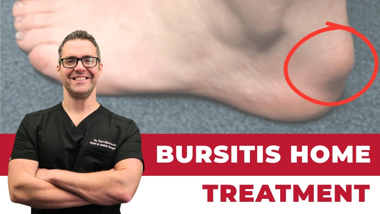 Heel Bursitis & Achilles Tendon Bursitis [Best HOME Treatment!]